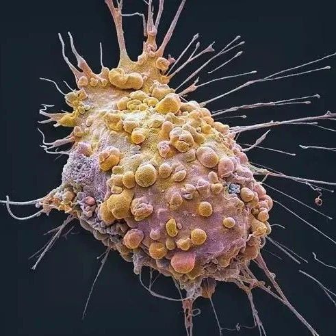 AI虚拟细胞开启生物研究新范式