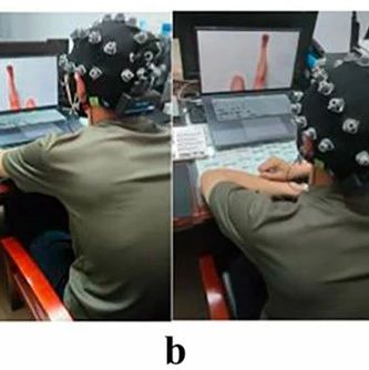 Scientific Data | 空军特色医学中心叶超群团队发布增强膝痛患者下肢运动想象EEG数据集分类研究