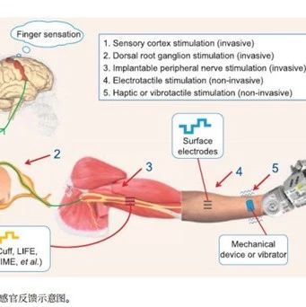 用于上肢假肢控制的非侵入性肌电神经接口的生物机械研究的10年回顾
