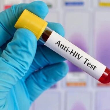 研究表明，女性或比男性更能有效地抑制HIV病毒库｜Science Translational Medicine