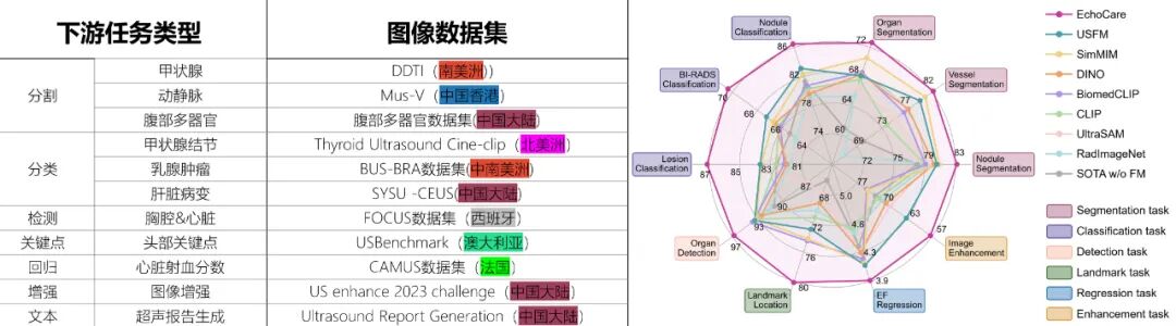 CAIR开源发布超声基座大模型EchoCare“聆音”，10余项医学任务性能登顶图4