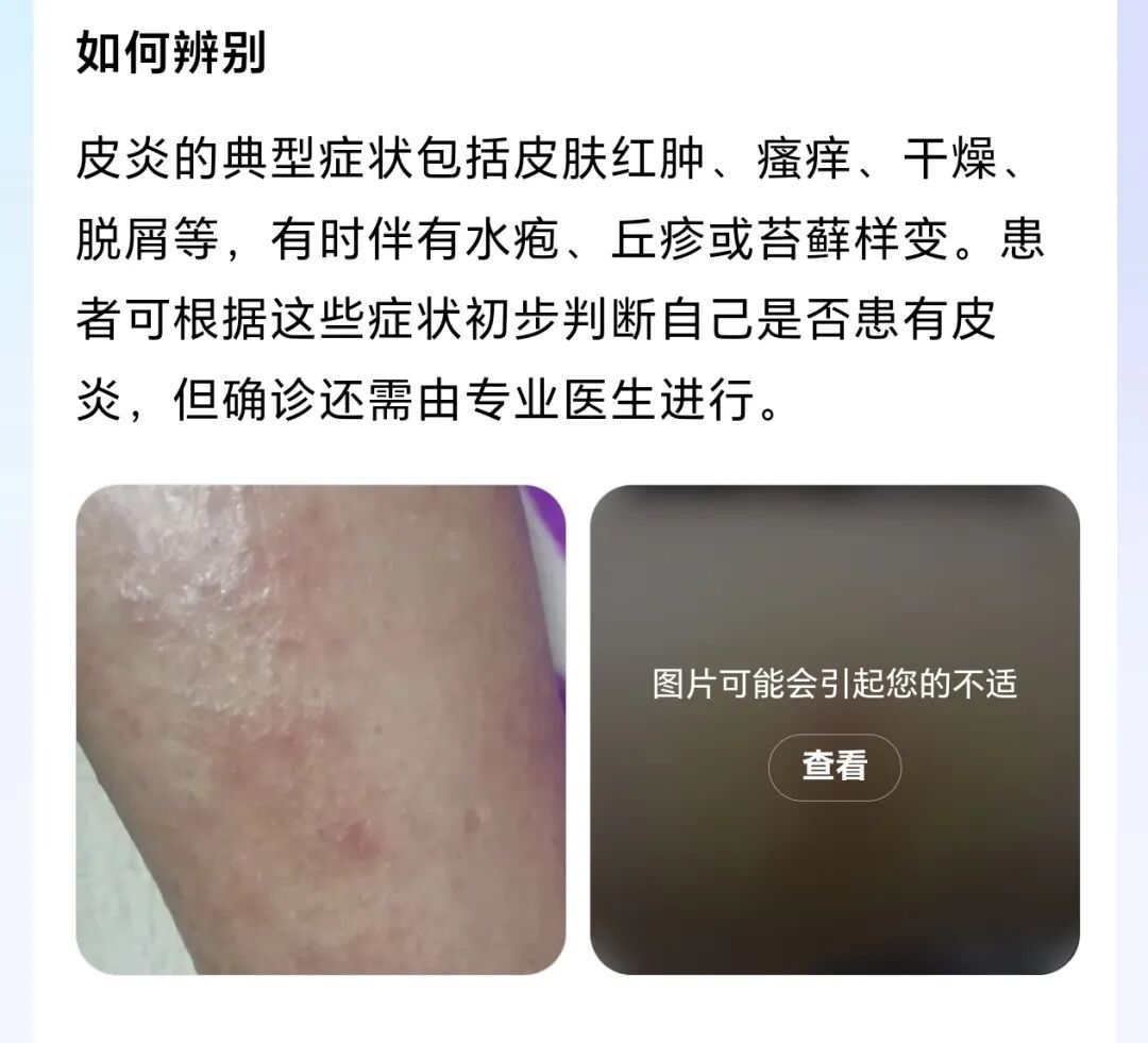 首创“AI+真人”双保障模式!刚刚,百度健康推出7x24小时「能聊、有料、会管」AI管家图8