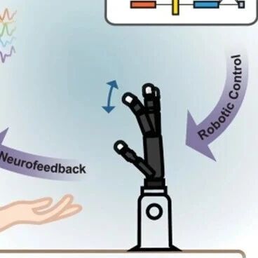 脑机接口辅助运动障碍患者精细运动新突破