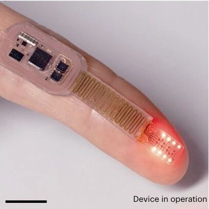 前沿 | 下一代全光学脑机接口突破：全植入式经颅光遗传系统