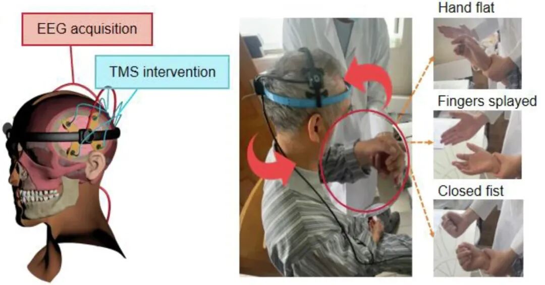 前沿 | 复旦团队研发用于脑卒中康复的便携式居家脑机接口图3