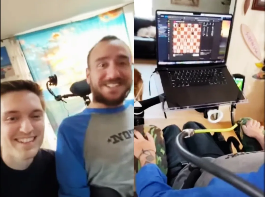 马斯克宣布量产脑机接口，几分钟一台手术？医生：出了问题谁负责图2