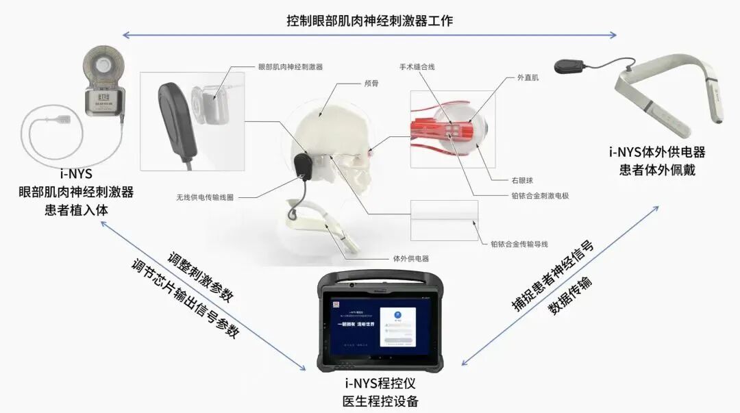 当前阶段，不要尝试和脑机接口抢 “ 风头 ”图4