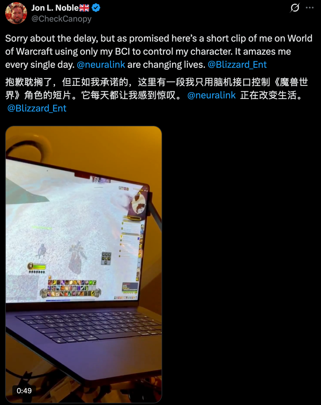 AI球球直播喊话全人类：开源脑机接口，开源科技文明图12