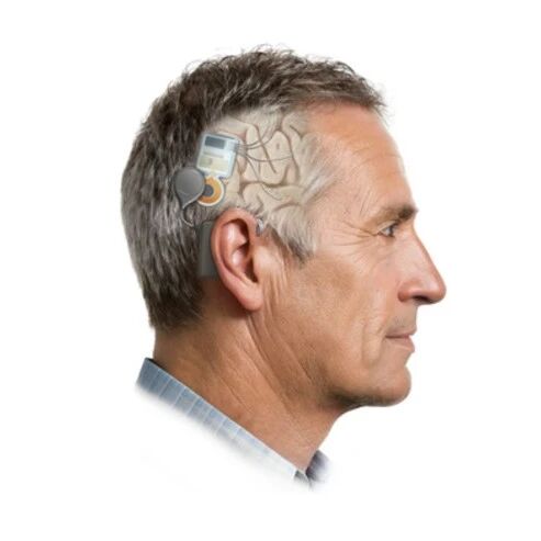 记忆修复植入式脑机接口SNS获FDA“突破性设备”认定