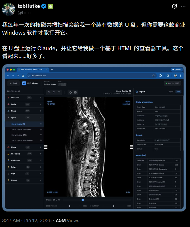 全网玩疯的SBTI,挤爆了服务器!网友用Claude手搓复刻版图36