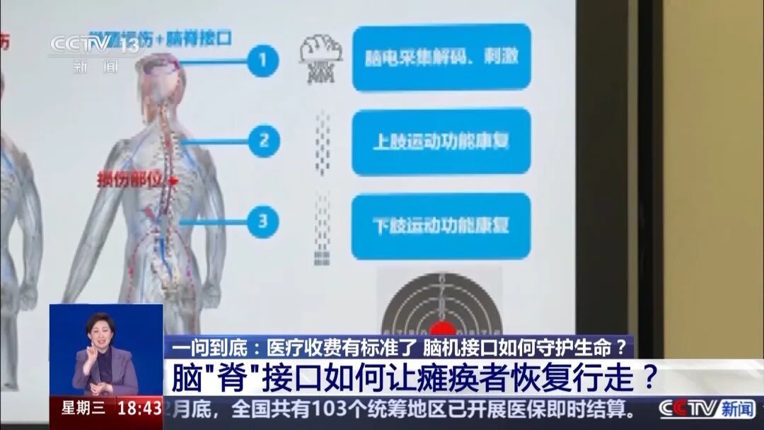 世界杯与脑机接口图4