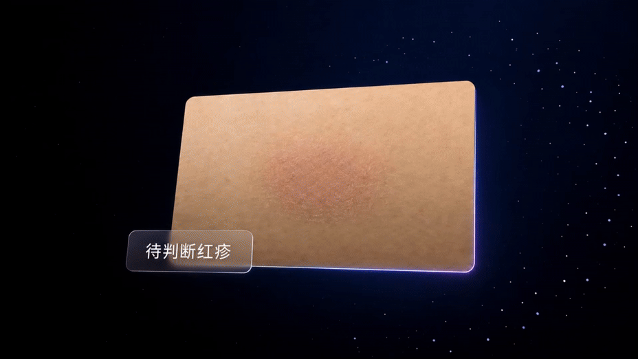 阿福化身福尔摩斯,皮肤界的AI侦探到底在查什么?图5