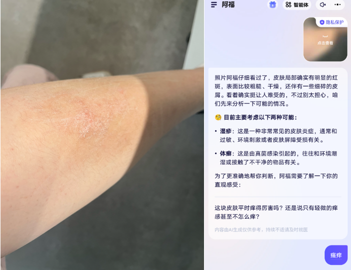阿福化身福尔摩斯,皮肤界的AI侦探到底在查什么?图7