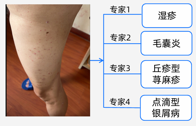 阿福化身福尔摩斯,皮肤界的AI侦探到底在查什么?图11