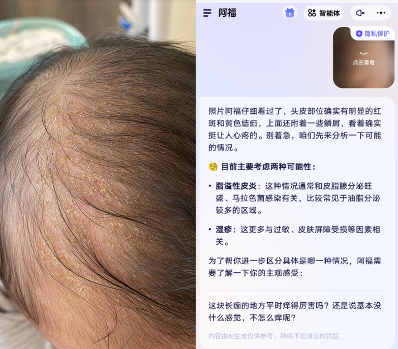 阿福化身福尔摩斯,皮肤界的AI侦探到底在查什么?图12