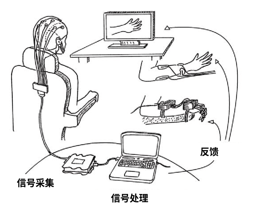 今年医学界给我的最大震撼，是脑机接口进医保了。图8