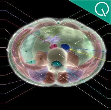 Midjourney新副业曝光：50万个传感器藏进浴池，60秒生成你的3D身体地图