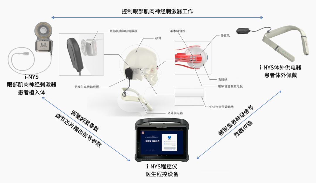 投融 | 超目科技完成D轮融资：眼科神经调控+视觉脑机接口图1