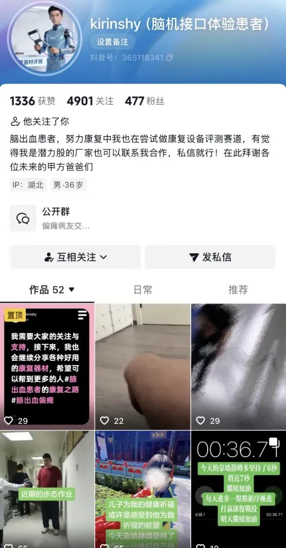 今年医学界给我的最大震撼，是脑机接口进医保了图7
