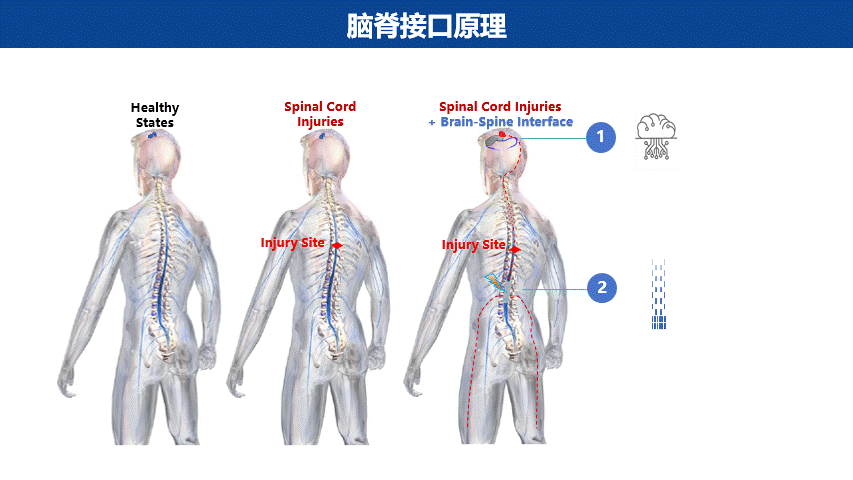观点 | 当神经调控遇到脑机接口图4