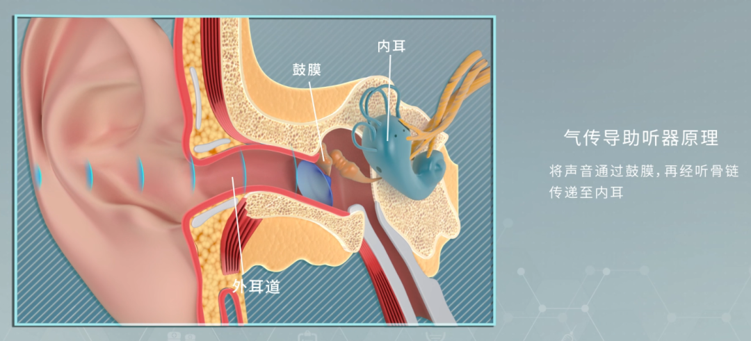 把助听器做得像耳机,左点G4用骨传导技术呵护耳朵 | 评测图5