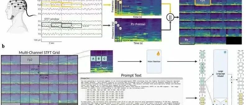 BraVista：将脑电信号转化为图像，用视觉-语言模型实现统一多任务EEG解码