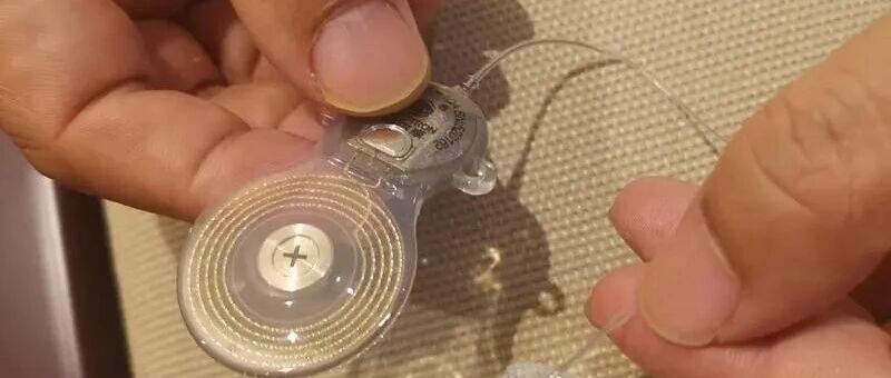 国产听觉脑机接口产品获批：诺尔康如何打通另一条听觉通路
